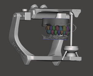 Photo n°11 de Docteur Fernando Duque chirurgie orale implants dentaires à Lyon (Dentiste)