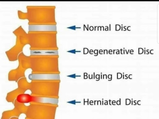 Dr bhupender Physiotherapist is the premier provider of physiotherapy. Our vision is to provide q…