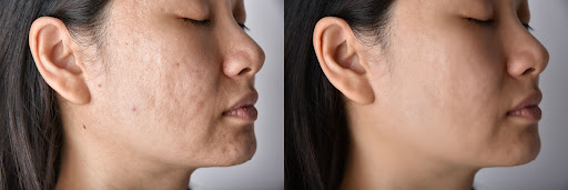 Roc Skin & Lash Studio - United States