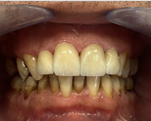 Studio dentistico Nicosia - Thumbnail