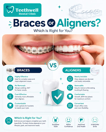 ✨ Braces or Aligners – Which One is Right for You? 🦷 post image