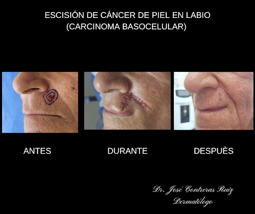 Dr. José Contreras Ruiz. Dermatólogo en Los Cabos - Thumbnail