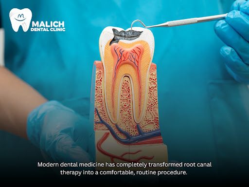 Are you putting off vital dental care because you believe a root canal is a painful experience? M… post image