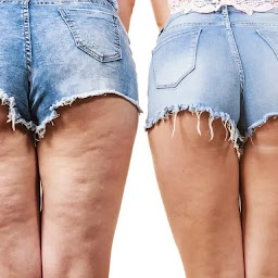 Photo n°13 de Céline PAIN à Arvert (Centre d'épilation laser)