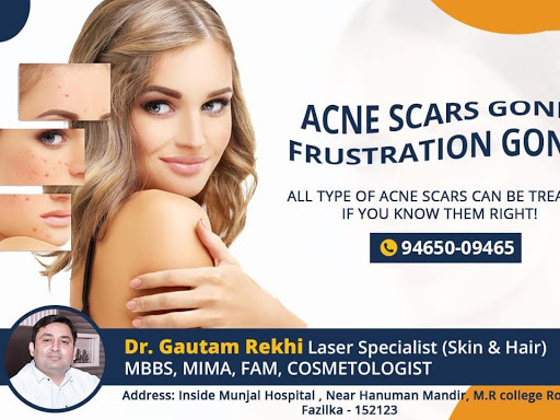 Dr. Gautam Rekhi says there are various type of acne scars and treatment of every scar is different.