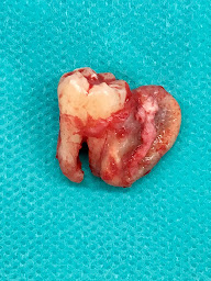 Photo n°10 de Dr Braticevic Alexandre à Marseille (Cabinet d'implants dentaires)