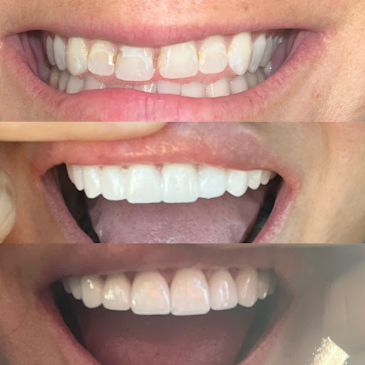 Burkburnett Family Dental - Thumbnail