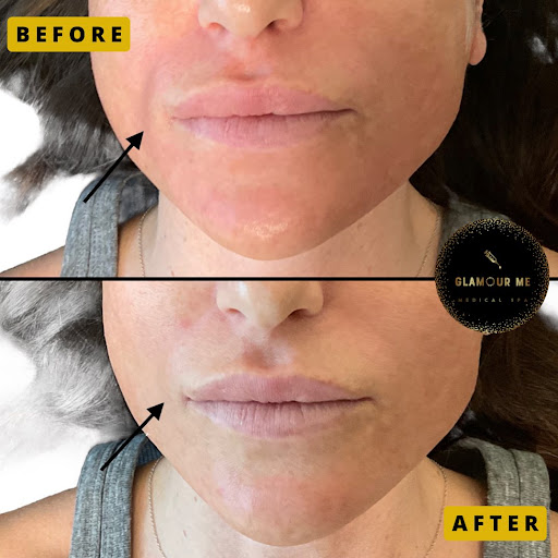 Glamour Me Medical Spa