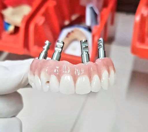 Erreci Dental S.N.C. di Recchia Enrico e Cinelli Enzo - Thumbnail