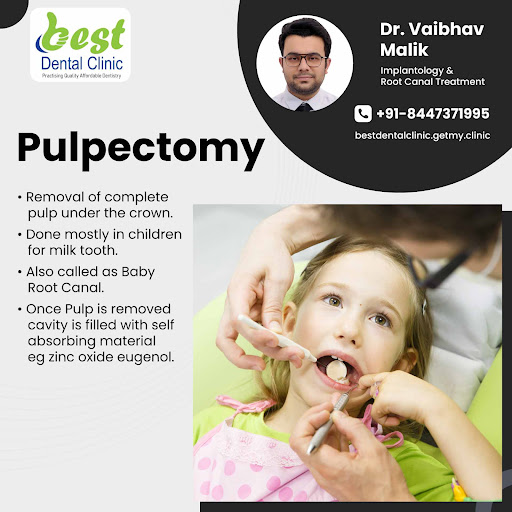 Pulpectomy is common dental procedure done for toddlers and it will not affect eruption of Perman… post image