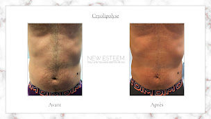 Photo n°17 de NEW ESTEEM à Dijon (Service d'esthétique)