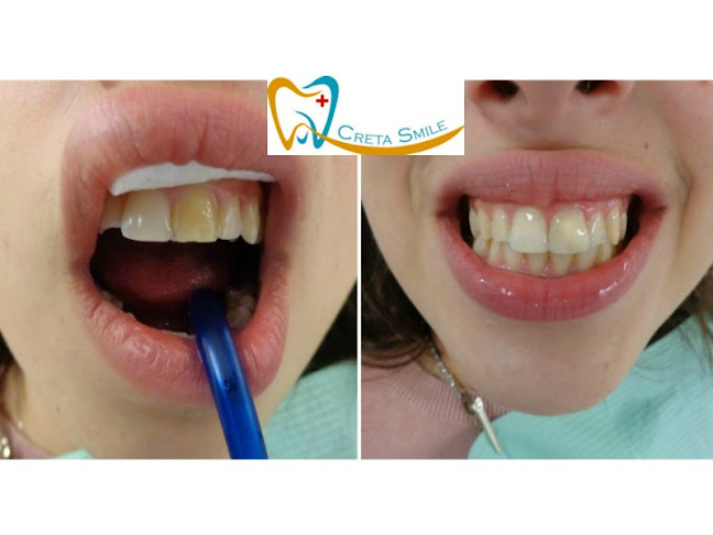 Creta Smile- Dental clinic - Οδοντίατρος