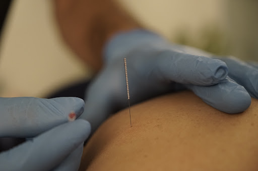Nicolás González - Fisioterapia Global | Mussa Pilates Center - Thumbnail