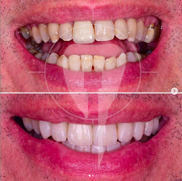 Photo n°15 de Dr Guillaume MARSIL à Grimaud (Dentiste)