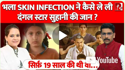 What is Dermatomyositis? Dangal Star Suhani Bhatnagar dies, Dr Deepali Bharadwaj Explains