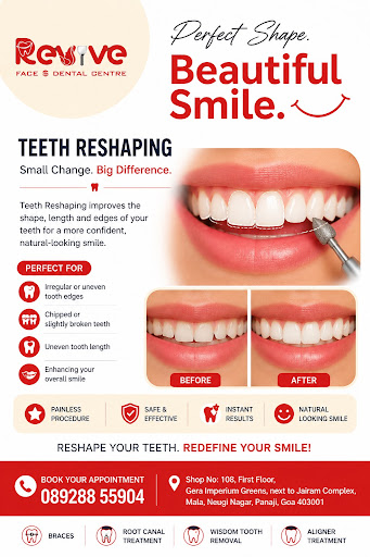 ✨ Teeth Reshaping at Revive Face & Dental Centre – Panaji, Goa ✨ post image