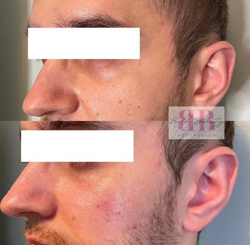 Bold Beauty Aesthetics - Thumbnail