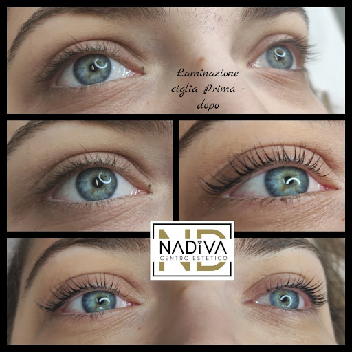 NADIVA - Thumbnail