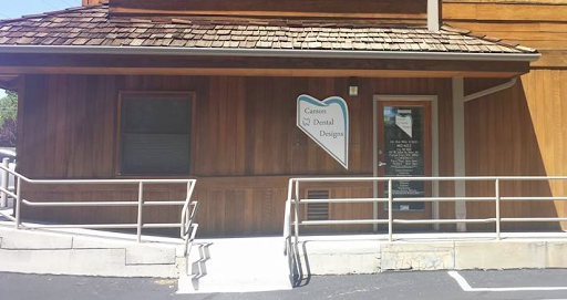 Carson Dental Designs