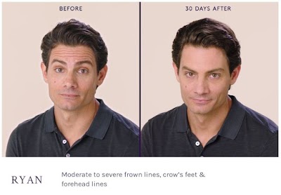 Facial Refinement