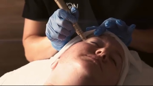 Hale Esthetics - Thumbnail