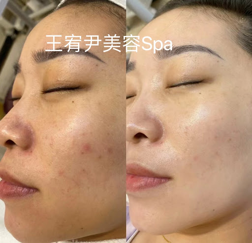 八里做臉 王宥尹美容SPA評價、營業時間、服務項目、價格 – 無痛清粉刺專業做臉 - Place thumbnail