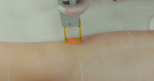 Photo n°5 de Centre Laser Murano Deauville à Deauville (Clinique)