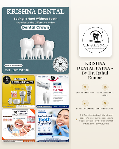 Visit Krishna Dental Patna for expert dental cleaning and teeth whitening. Trusted dental doctor… post image