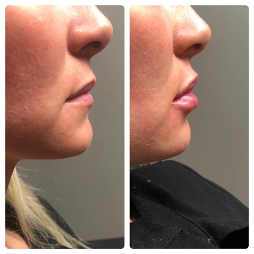 Innovative Aesthetics Medical Spa and Laser Center