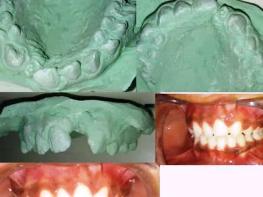 #braces doctor in Gorakhpur, post image
