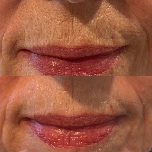 Benessere On The Hill