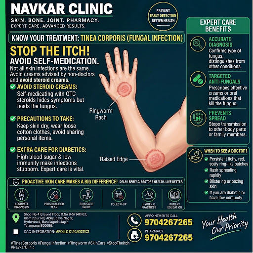 Stop the Itch! Why Self-Medicating Your Skin Infection is a Dangerous Game 🛑🦠 post image