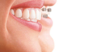 Photo n°7 de Dr Claudio LANCIA - Chirurgien Dentiste-Pratique de l'orthodontie à Verneuil d'Avre et d'Iton (Médecin)