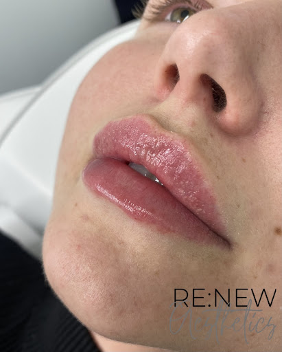 Renew Aesthetics Specialist