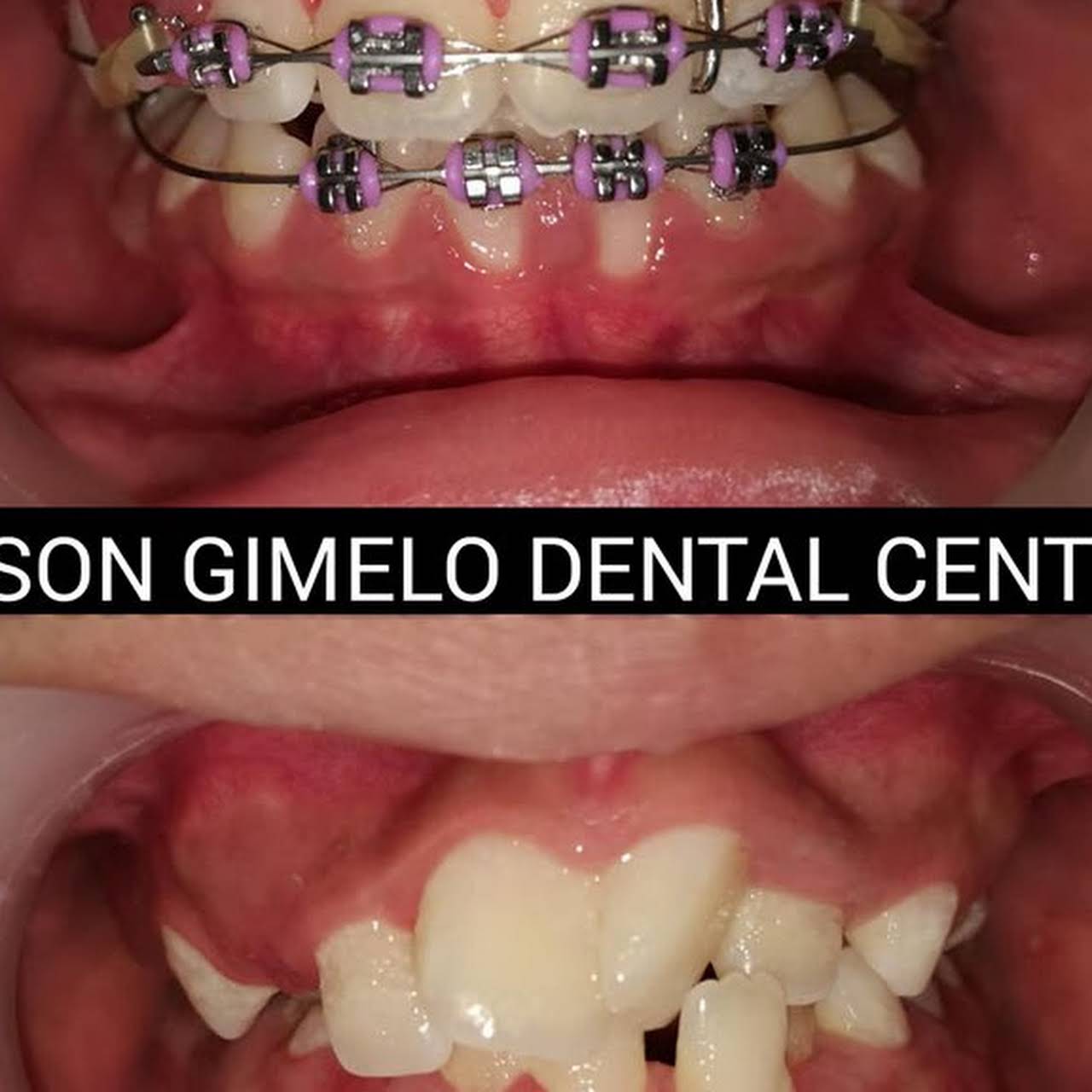 Sison Gimelo Dental Center Marikina Dental Clinic in St