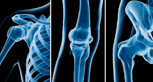 Photo n°15 de Dr Elliott Kierszbaum - Chirurgien Orthopédiste Paris -Clinique Maussins-Nollet à Paris (Médecin du sport)