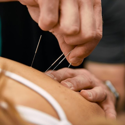 Portside Sports Physiotherapy - Thumbnail