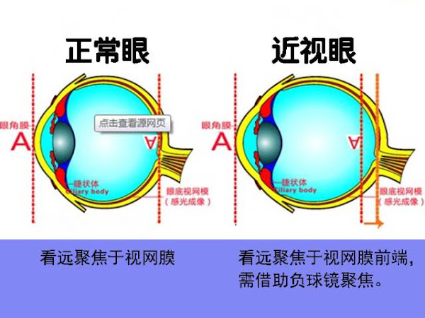 Dr Min Zhang Od 星视明眼科法拉盛眼科 法拉盛眼科医生配眼镜纽约配眼镜眼科医生 纽约眼科医生法拉盛配眼镜法拉盛眼镜 纽约眼科纽约唐人街 眼科法拉盛眼科诊所眼科检查