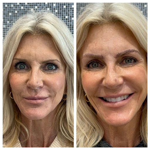 Daniz Brow Design at Salon World Suites