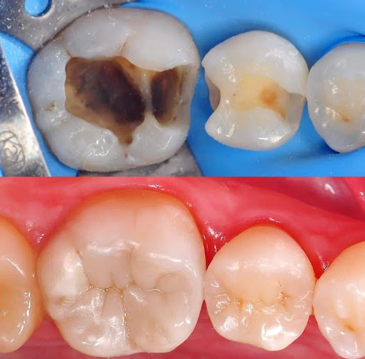 Clínica Dental Natale - Thumbnail
