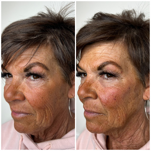 Elixir Med Spa - Visual