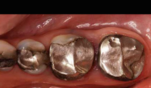 ProSmiles Dentist Collingwood - Thumbnail