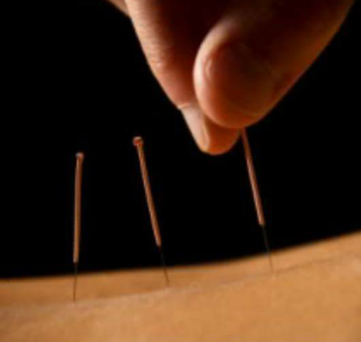 Acupuncture and Traditional Chinese Medicine - Tony Booth