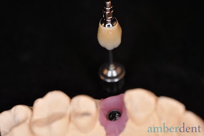 Photos of Amberdent Clinic
