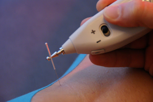 Clínica de fisioterapia Lyceum | Fisioterapia Majadahonda. Tu fisio en Majadahonda - Thumbnail