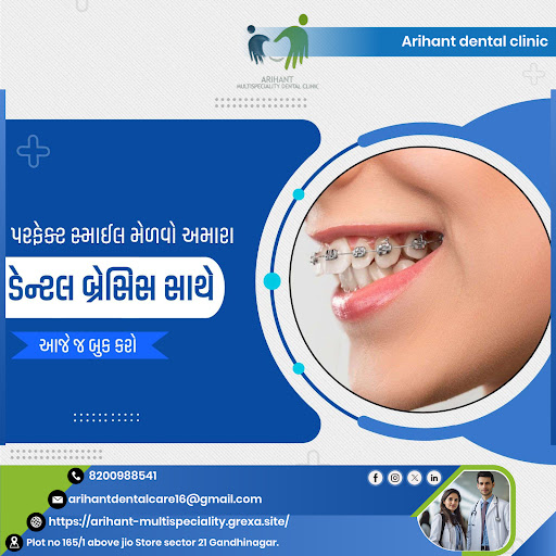 "બ્રેસિસ ડૉક્ટર ગાંધીનગર સેક્ટર 21" post image