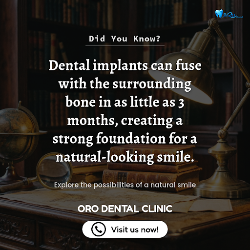Dental Implants post image