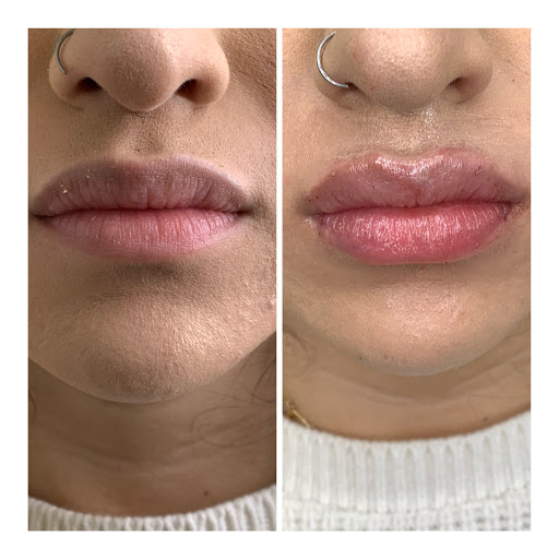 DS Skin & Lips Medical Spa