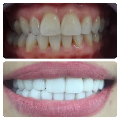 Photos of Elite Dental Clinic
