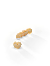 Photo n°11 de Laboratoire Crown Ceram à Aspach-Michelbach (Centre de prothèses dentaires)